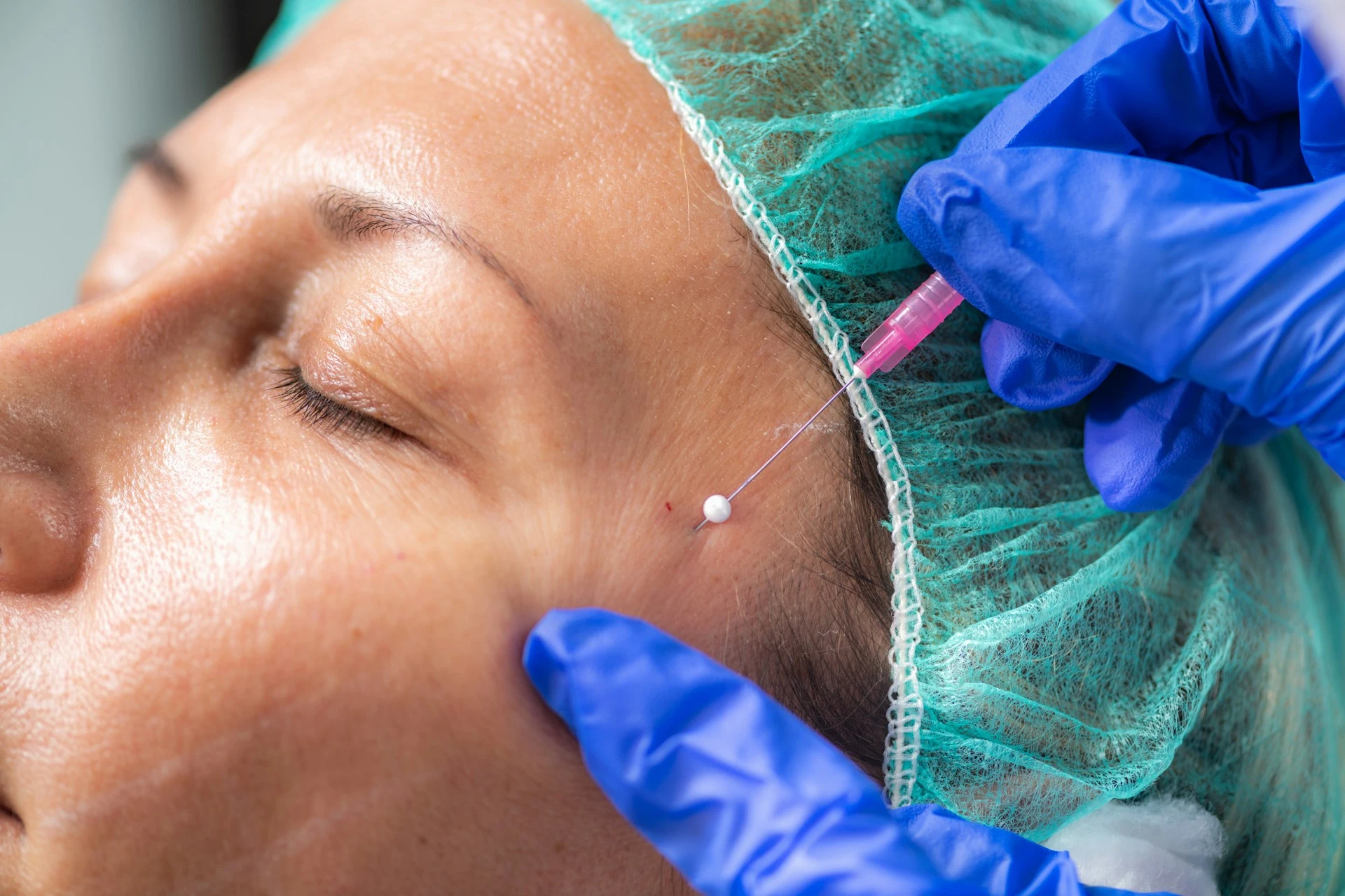 Procedimento de Harmonização Orofacial